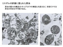 リスザルの肝臓に見られた原虫