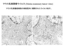 マウス乳腺腫瘍ウイルス