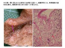 牛第一胃に見られた丘疹性口炎