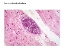 Sarcocystis miescheriana