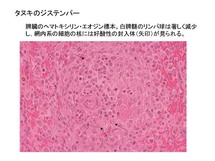 タヌキのジステンパー