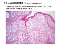 カモシカの伝染性膿瘡