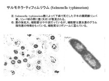 Salmonella typhimurium