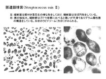 Streptococcus suis II