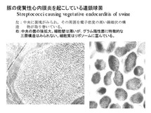 Streptococcus suis 心内膜炎