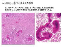 Actinomyces bovis