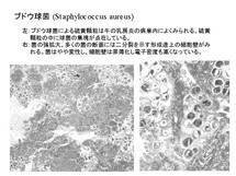 Staphylococcus aureus