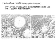 Aspergillus fumigatus