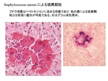 Staphylococcus aureus