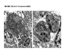 豚の肺に見られたToxoplasma gondii