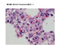 豚の肺に見られたToxoplasma gondii