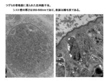 ツグミに見られた住肉胞子虫