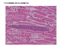 ツグミに見られた住肉胞子虫