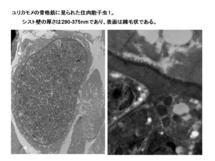 ユリカモメに見られた住肉胞子虫