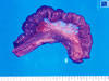 腸の充血、腸間膜リンパ節の腫大 