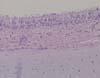 気管粘膜上皮に多数の好酸性細胞質内封入体が観察される。 HE染色、x400