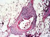 肺虫による寄生虫性肺炎、HE染色。