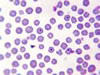 血液塗沫像、赤血球の中央部付近に原虫が寄生 