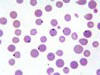 血液塗沫像、赤血球の周縁部に原虫が寄生 