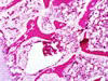 第2胸髄の造血細胞の消失、HE染色