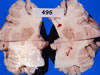 小脳髄体の壊死巣(2ヵ所)― 固定後所見 