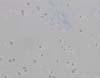 感染病理No.4086, 変性した有棘細胞の核内における牛パピローマウイルス抗原陽性反応 皮膚,免疫染色