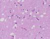 延髄(閂部)、孤束核。神経網の空胞化がみられる。 HE染色、x600。