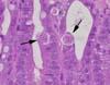 粘膜上皮細胞内のマクロガメート 小腸、HE染色、x1000