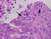粘膜上皮細胞内の1型メロント 小腸、HE染色、x1000