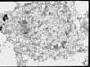 ウイルスが感染した神経細胞 透過型電子顕微鏡像