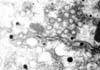 細胞質内のウイルス粒子。 透過型電子顕微鏡像