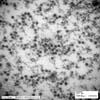 核内のウイルス粒子 皮膚有棘細胞,透過型電子顕微鏡像
