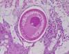 結腸粘膜に付着した鞭虫の高拡大像。