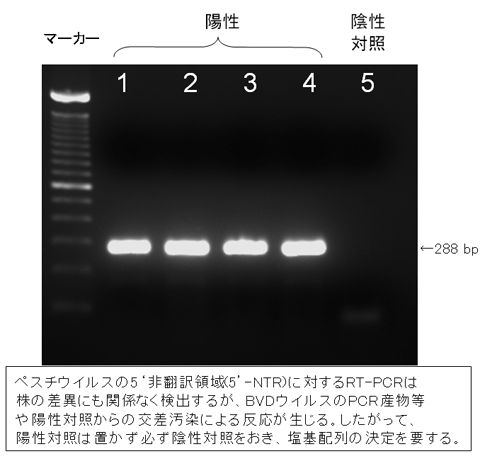 図11. 抗体検査のフローチャート