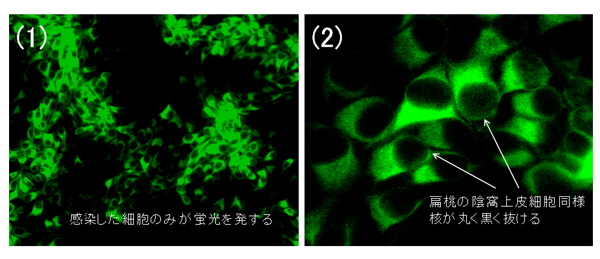 写真10.ウイルス分離(蛍光抗体法)