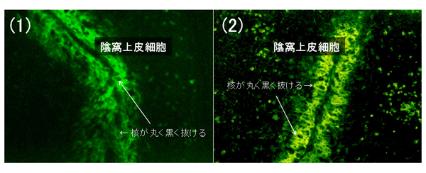 写真9.扁桃の凍結切片法(蛍光抗体法)