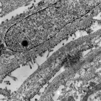 電子顕微鏡写真