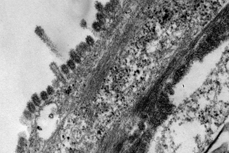 電子顕微鏡写真