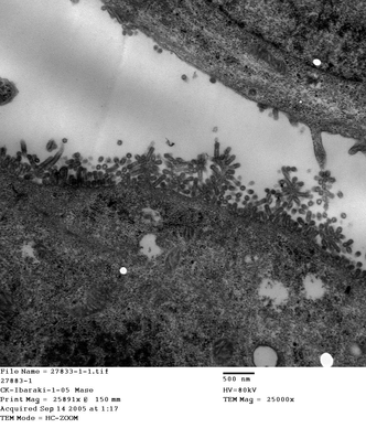 電子顕微鏡写真