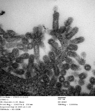 電子顕微鏡写真