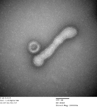 電子顕微鏡写真