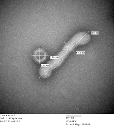 電子顕微鏡写真