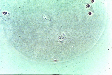 受精初期卵