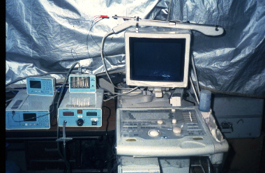 超音波画像診断装置の写真