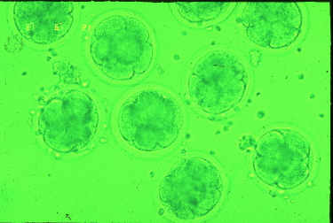 体外受精による受精初期卵