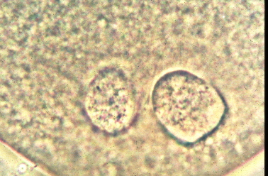 雌雄前核と分離精子尾部