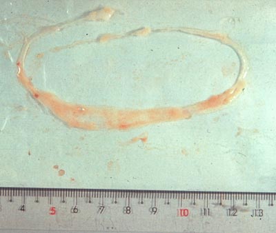 発情後20日目の牛胚