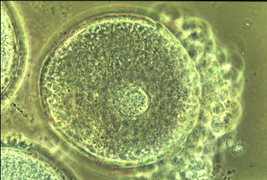 未成熟な卵子(卵核胞期)