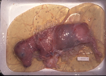 推定妊娠日齢110～120日齢の羊膜中の胎子