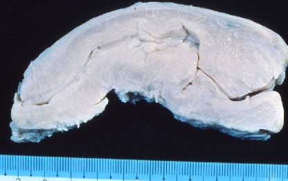 牛子宮頚管の縦割矢状面
